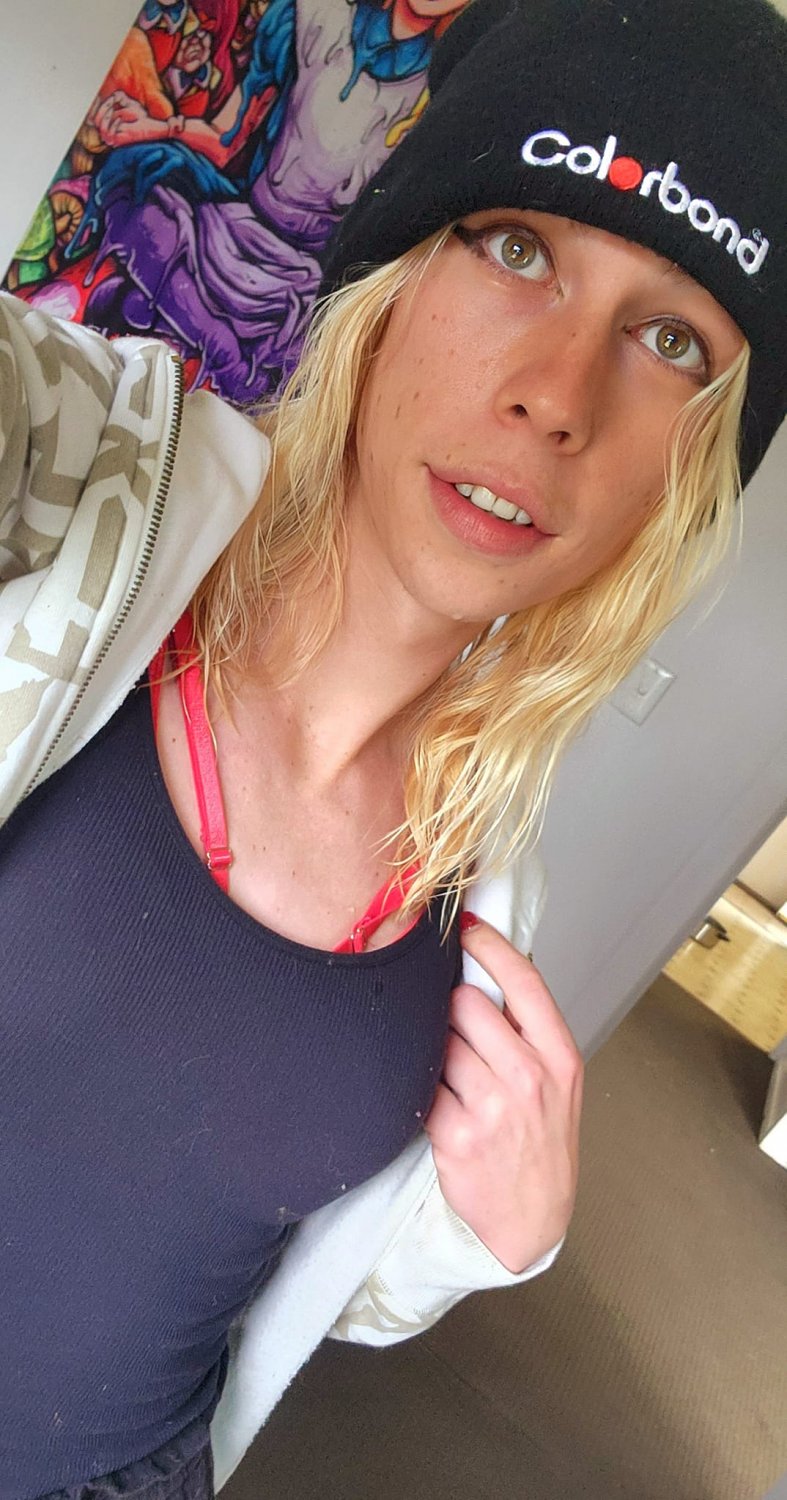 Disclosure #266: Aussie Transgirl #dzrDgWGs